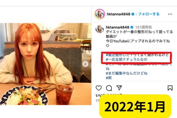 2022年1月：インスタグラムで整形疑惑を否定